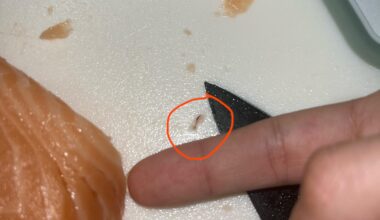 Whats this brown thing in my salmon sashimi ? Is it still safe to eat?