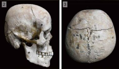 Japan’s Hirota People Were Reshaping Infants’ Heads 1,500 Years Ago